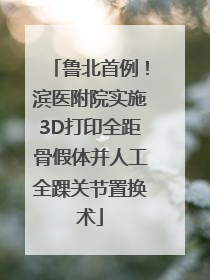 鲁北首例！滨医附院实施3D打印全距骨假体并人工全踝关节置换术